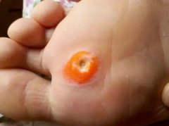 ����һ��ҪȥҽԺ��